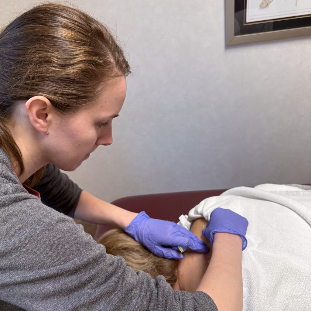 Emily Dry Needling